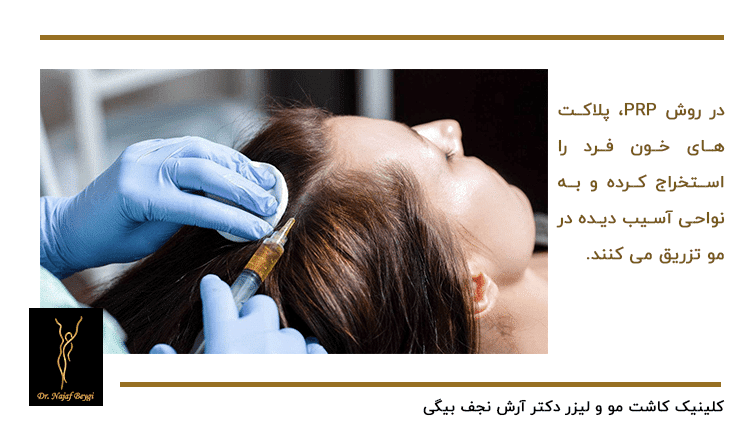 تزریق PRP به سر زن مراجعه کننده که دارای ریزش مو است