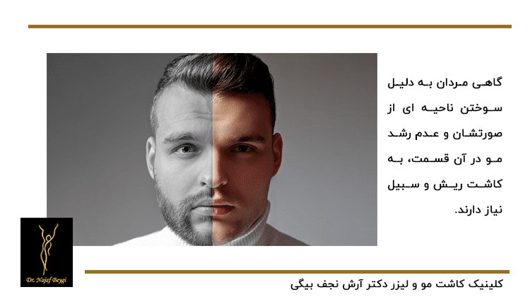 تفاوت داشتن سبیل و ریش در چهره مردان