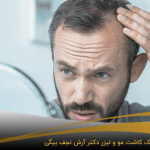 روش پی ار پی برای درمان ریزش مو