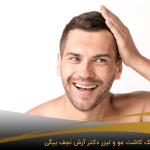 کاشت مو به روش فیت برای آقایان