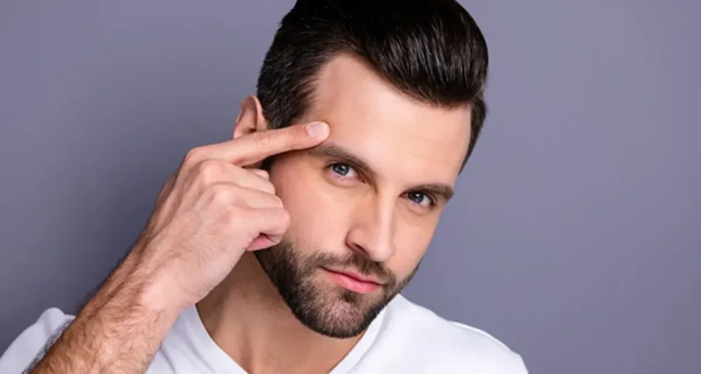 کاشت ابرو مردانه