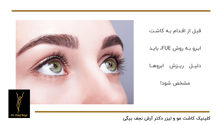 کاشت ابرو به روش FUE و اهمیت دلیل ریزش مو