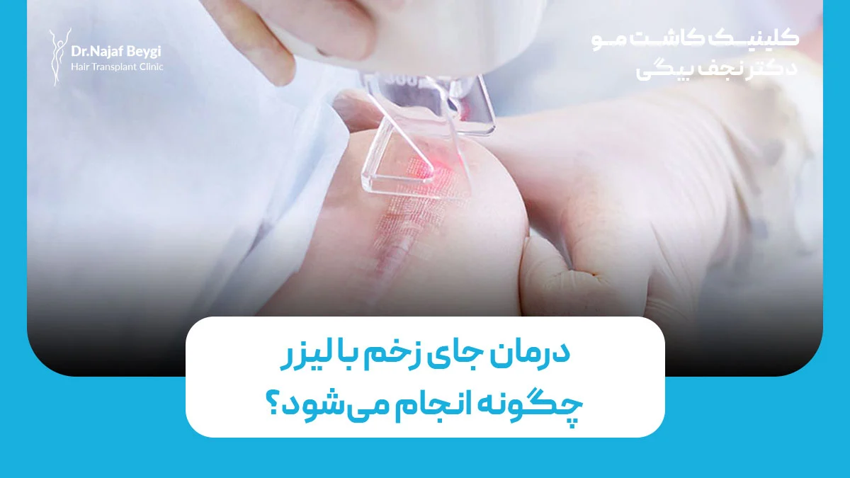 لیزر جای زخم