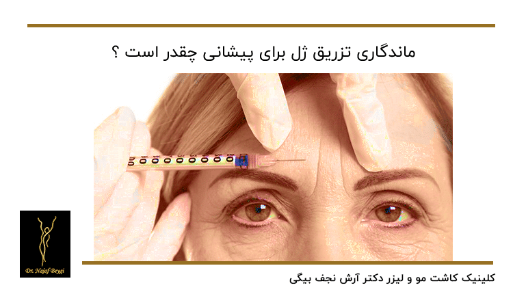 تزریق ژل برای خطوط چروک روی پیشانی