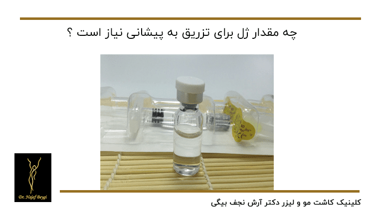 ژل برای تزریق به پیشانی و صورت