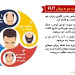 مراحل کاشت مو به روش FUT