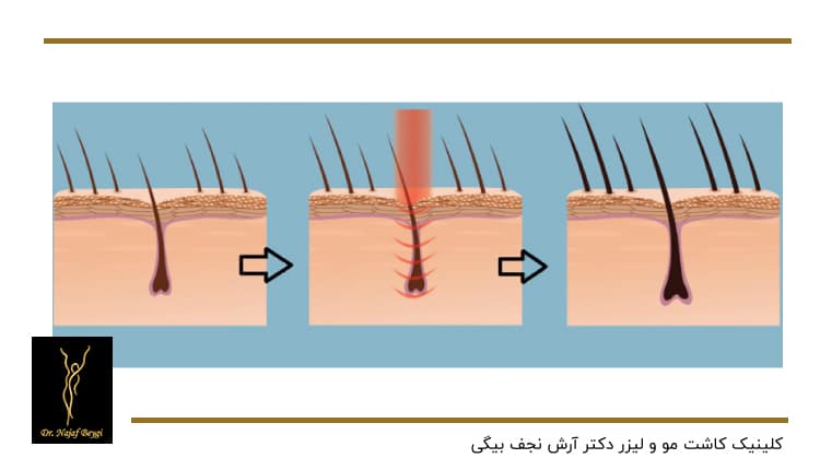 چرخه سه مرحله ای رشد مو