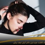 پروتز موی زنان