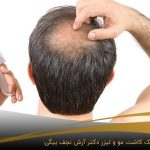 مردی که دچار ریزش مو شده است