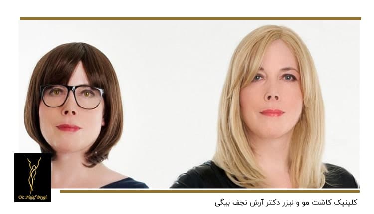 انواع پروتز مو
