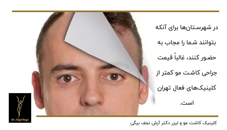 قبل و بعد از کاشت مو