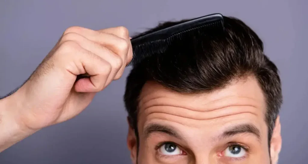 ایمپلنت کاشت مو