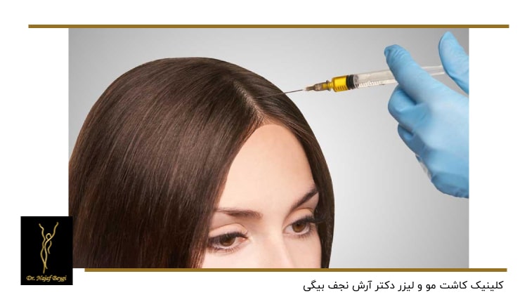تزریق به پوست سر یک زن