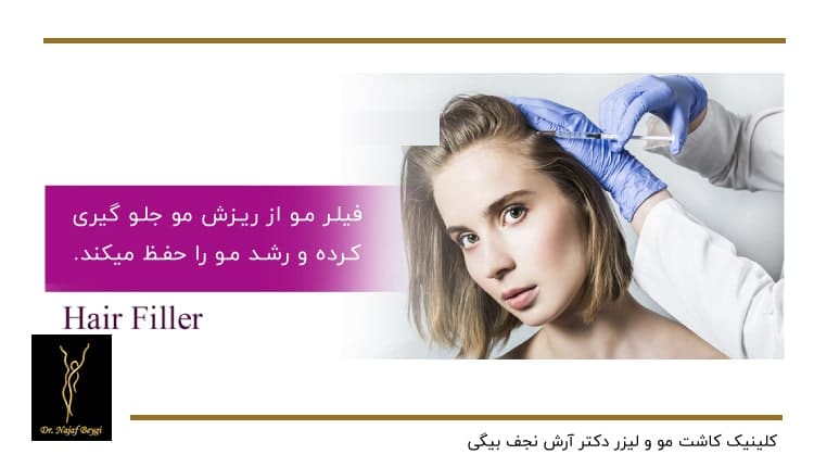 جلوگیری فیلر مو از ریزش مو و حفظ رشد آن