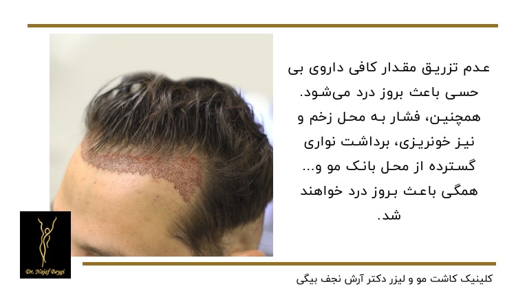 زخمی که بر اثر ترمیم خط رویشمو ایجاد شده بر روی سر