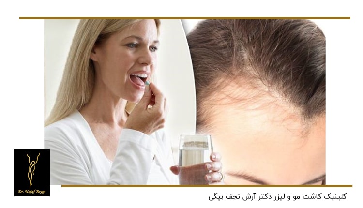 مصرف دارو بعد از کاشت مو