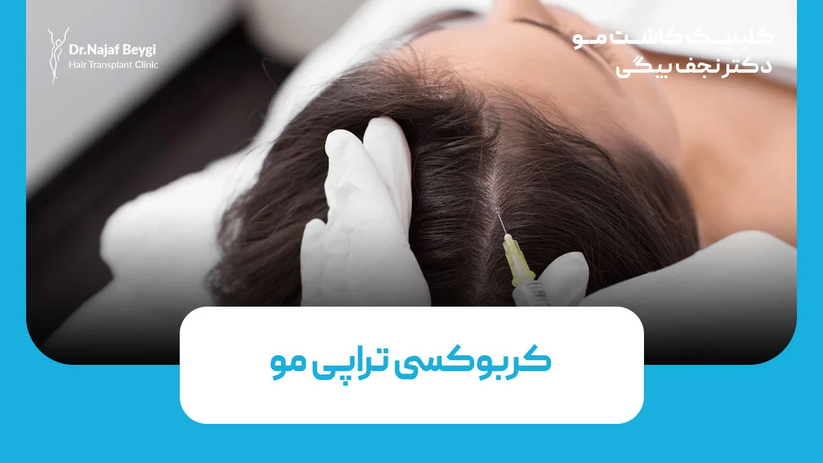 کربوکسی تراپی مو