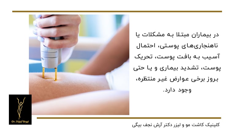 لیزر موهای زائد پا