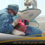 کاشت مو مردی با دستگاه اتوماتیک