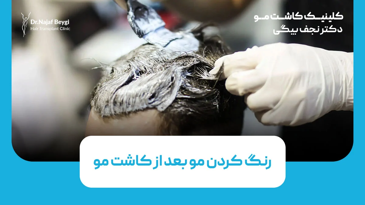 رنگ کردن مو بعد از کاشت مو