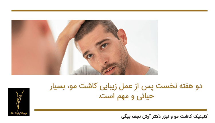 زمان رابطه جنسی بعد از کاشت مو