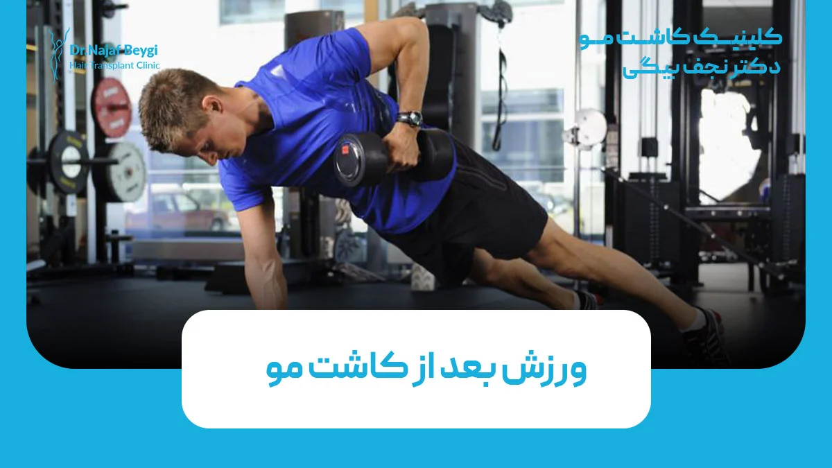 ورزش بعد از کاشت مو