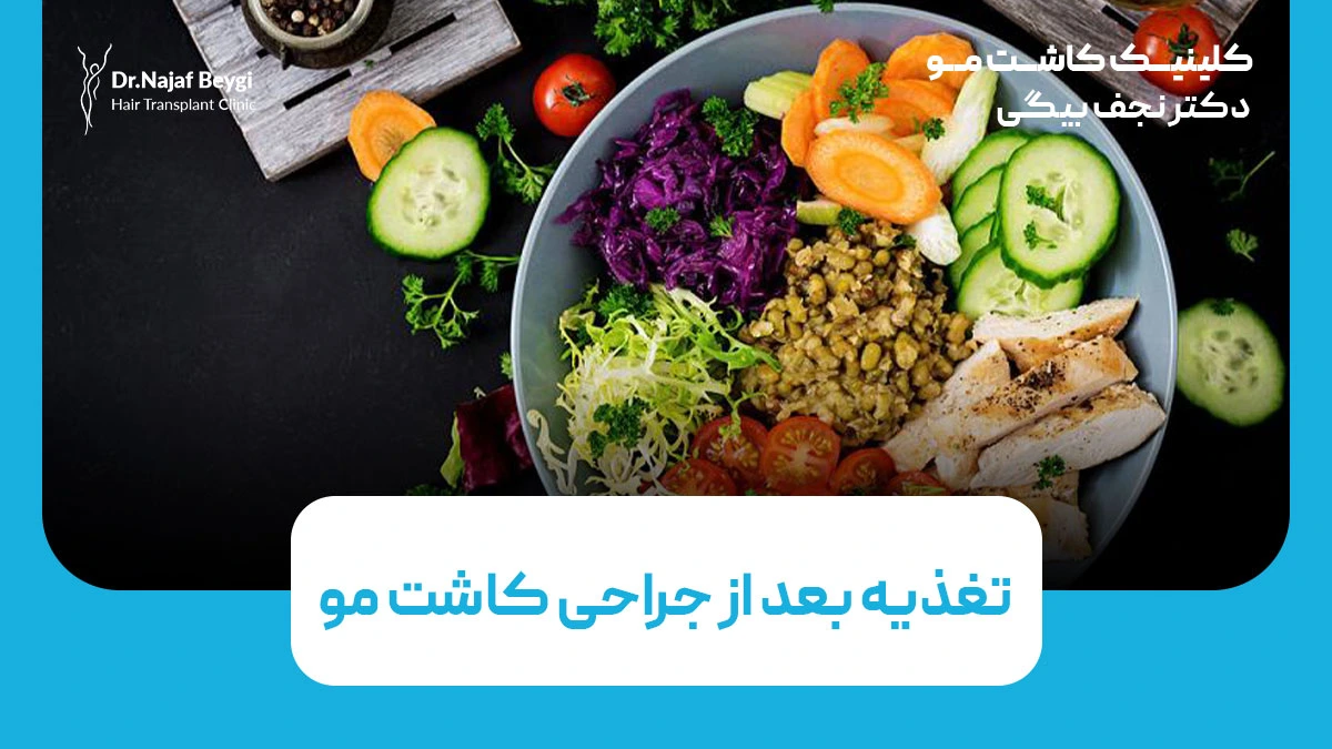 تغذیه بعد از جراحی کاشت مو