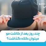 چند روز بعد از کاشت مو میتوان کلاه گذاشت