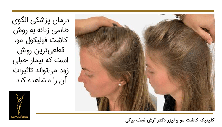 درمانهای پزشکی برای الگوی طاسی زنانه