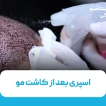 اسپری بعد از کاشت مو