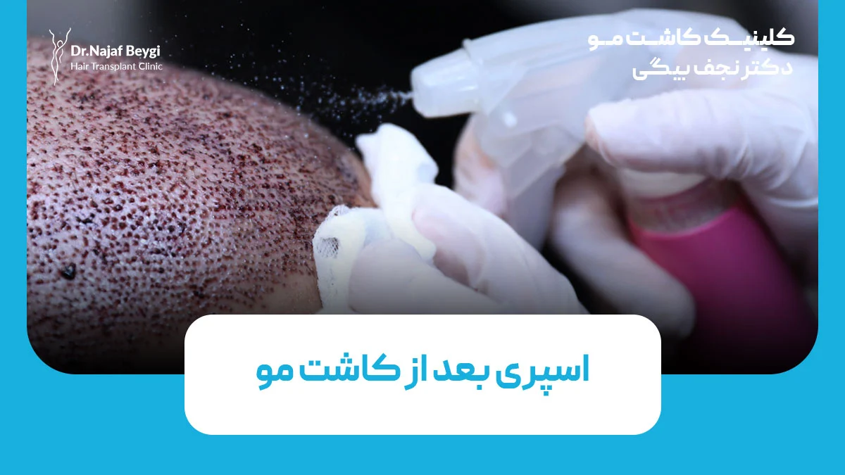 اسپری بعد از کاشت مو