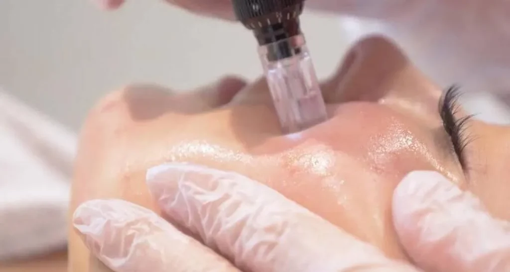 مزونیدلینگ فیشال