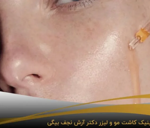 مزونیدلینگ فیشال؛ روشی موثر و مطمئن برای جوانسازی پوست