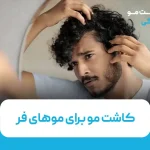 کاشت مو برای موهای فر