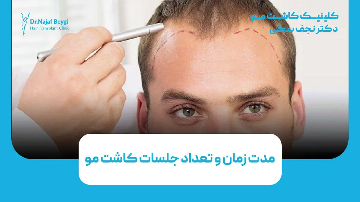 مدت زمان و تعداد جلسات کاشت مو