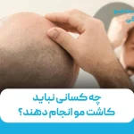 چه کسانی نباید کاشت مو انجام دهند؟