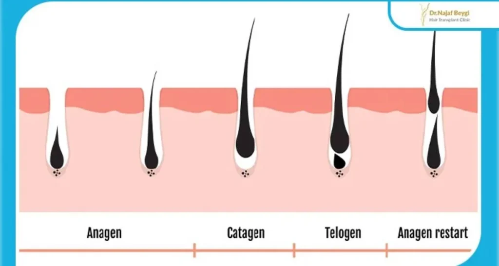 اختلالات هورمونی و ریزش مو در زنان و مردان