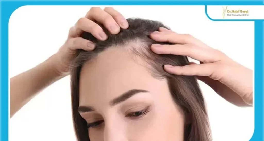 ارتباط هورمون ها در رشد مو