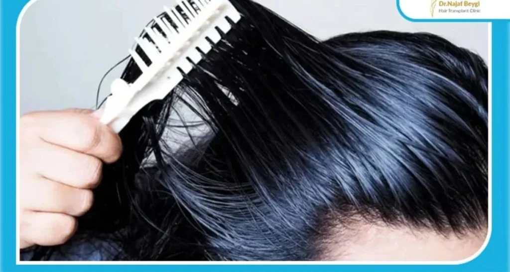 اگر پوست سر چرب باشد کاشت مو جواب می دهد؟