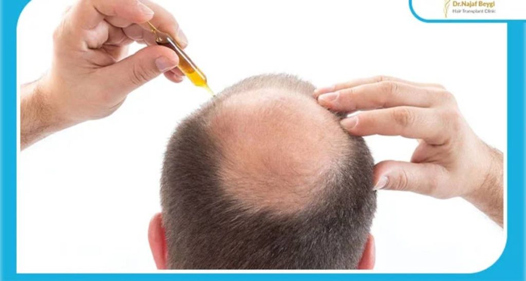 بانک مو و گرافت مو چیست