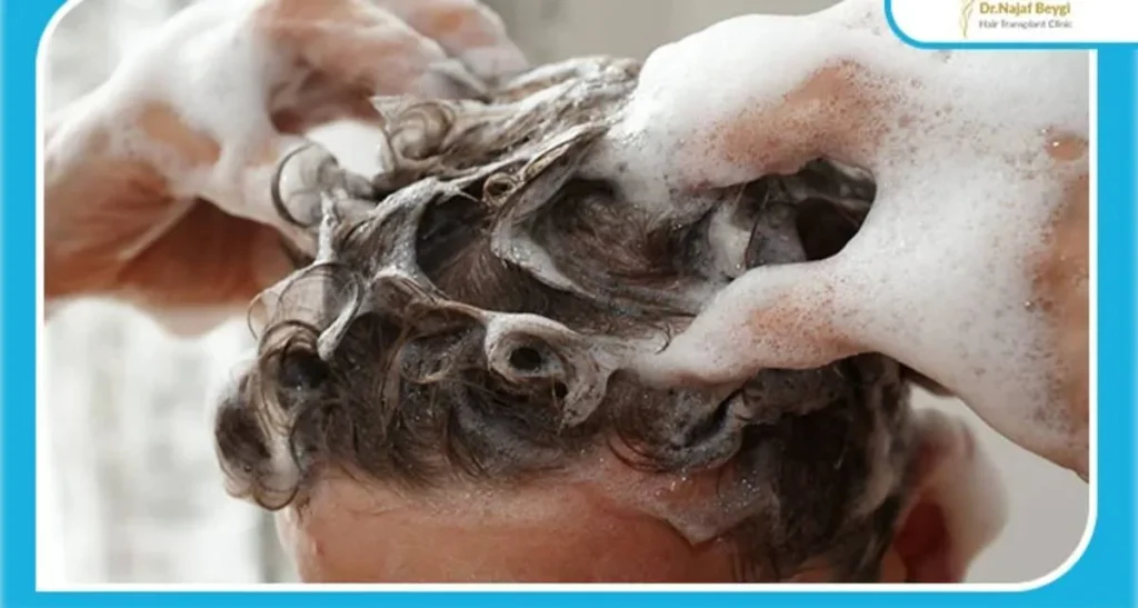 شرایط کاشت مو برای موی چرب