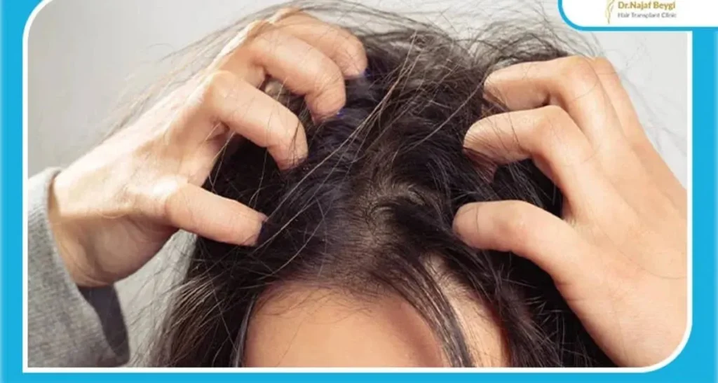 نشانه های کاشت موی موفق