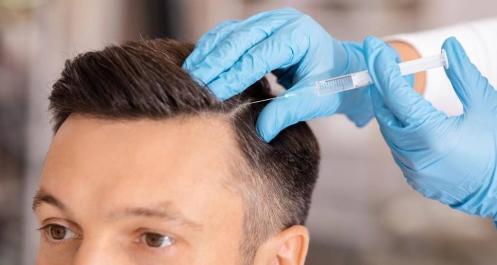 نکات خوردن چای بعد از کاشت مو