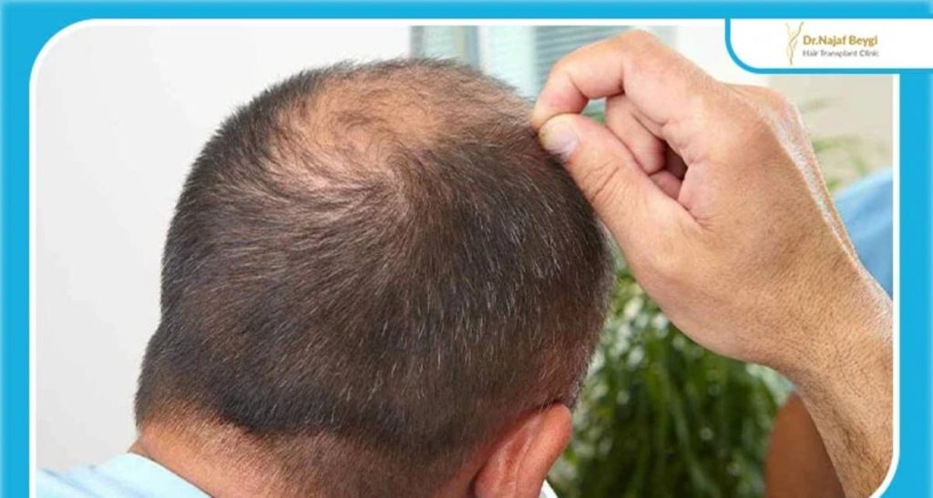 همه چیز درباره بانک مو