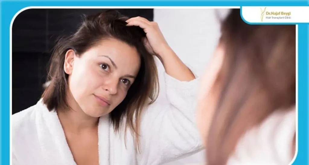 کاشت مو برای موی چرب