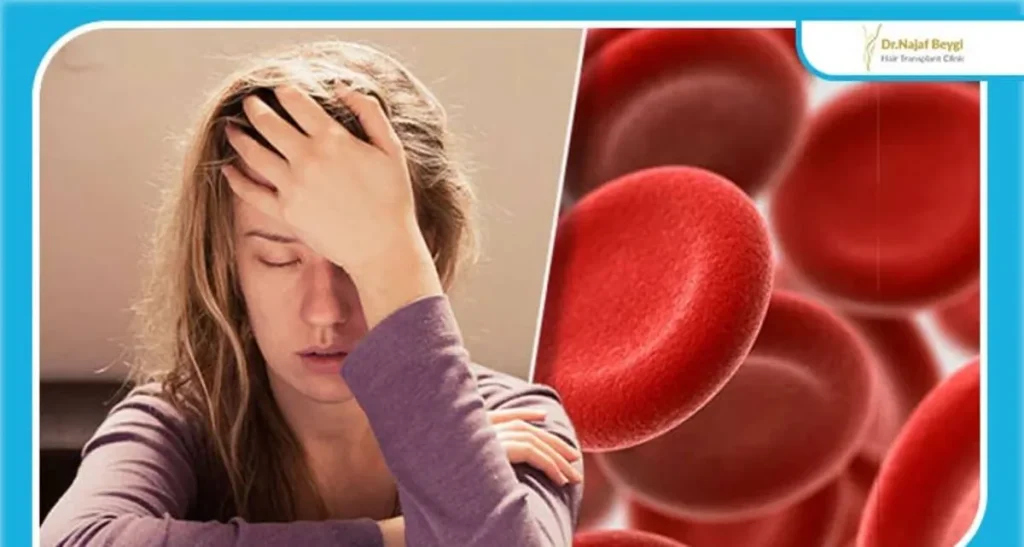 آیا کمبود آهن باعث ریزش مو می شود؟