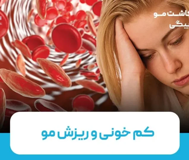 آیا کم خونی باعث ریزش مو می‌شود؟
