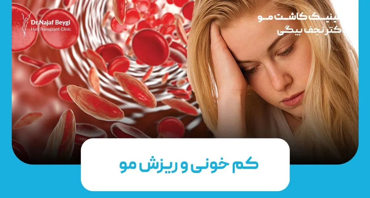 آیا کم خونی باعث ریزش مو می‌شود؟