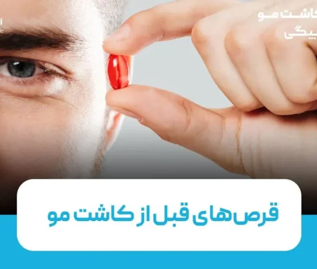 قرص‌های قبل از کاشت مو: بهترین انتخاب‌ها برای تقویت فولیکول‌ها