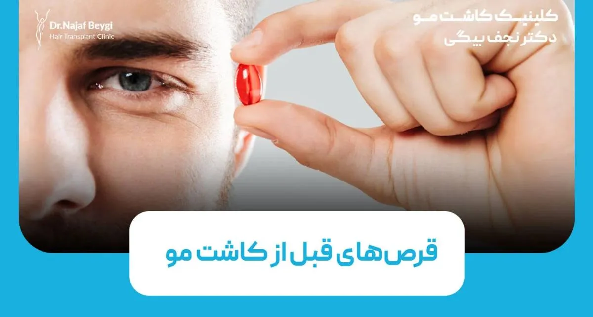 قرص‌های قبل از کاشت مو: بهترین انتخاب‌ها برای تقویت فولیکول‌ها